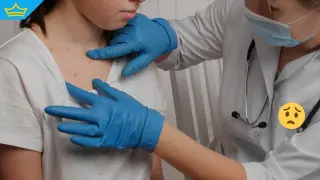 Отчитат бум на варицела и стомашни инфекции от началото на юни