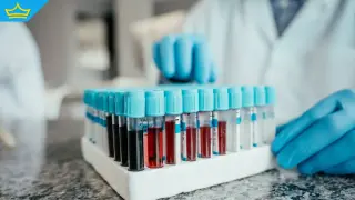 Кръвен тест засича над 50 вида рак: 99% точност при отрицателни резултати (видео)