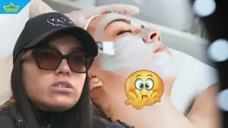 26-годишна жена е с изгаряния II степен след „безвреден“ пилинг в салон за красота (видео)