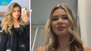 Участничка в "Ергенът" също е имала проблем след поставяне на ботокс (видео)