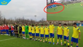 Млад футболист удари жестоко свой противник, изпрати го в болница с черепно-мозъчна травма и хематом (видео)