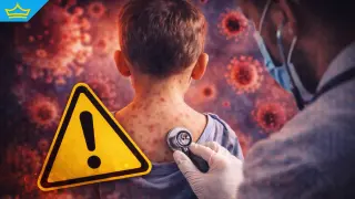 Морбили се разпространява в пет области у нас