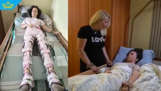 Момиче от Пловдив се бори за нов живот след тежка катастрофа (видео)